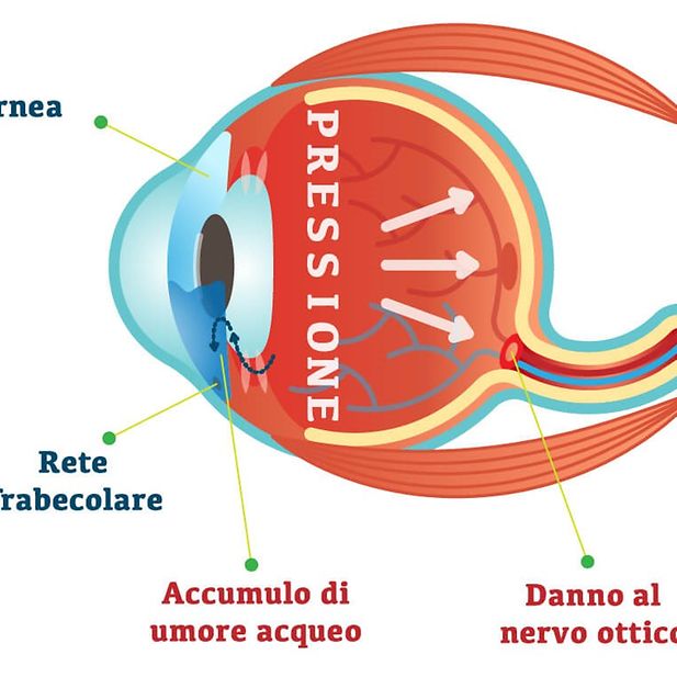 ww_Cos’è_il_row_3