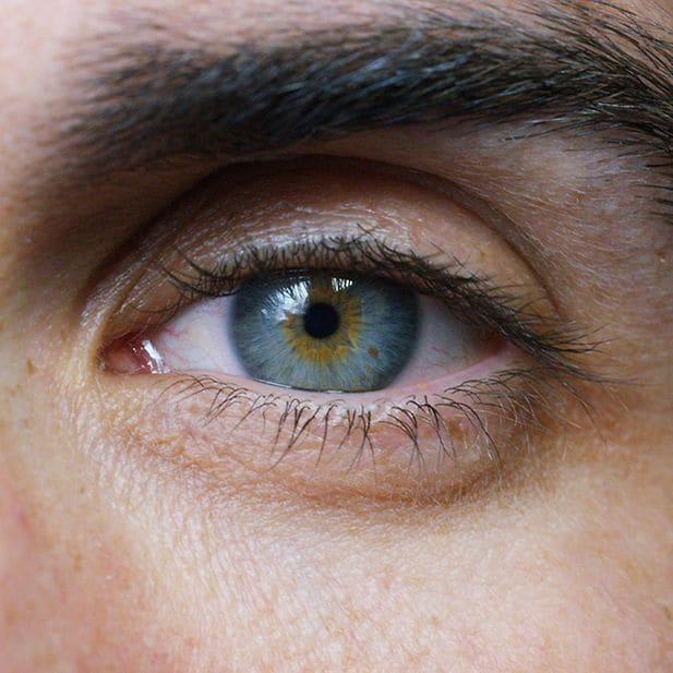 effects_roaccutan_on_eyes_row_9