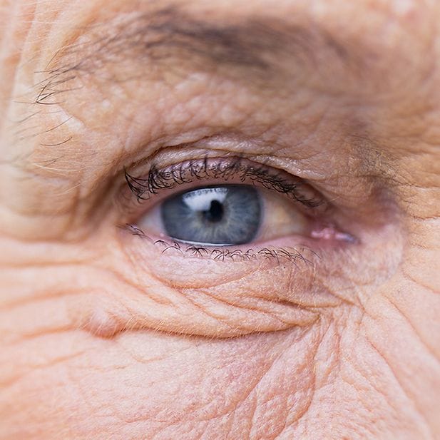 What-Does-Eye-Colour-Depend-On-Row-7