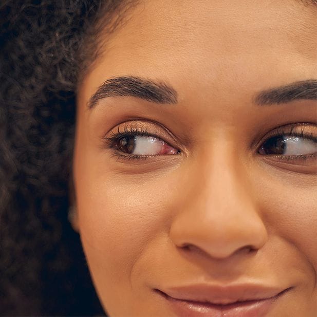 Volto di ragazza sorridente che guarda di lato